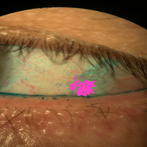 LG-Staining-Eyeball Sclera-segmented